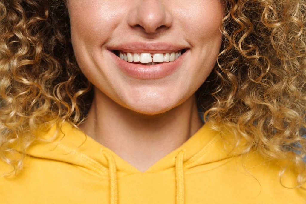 Spacing Between Teeth