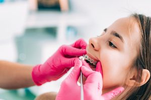 Young girl receiving orthodontic examination with pink gloves in dental office setting.