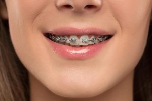 Orthodontics