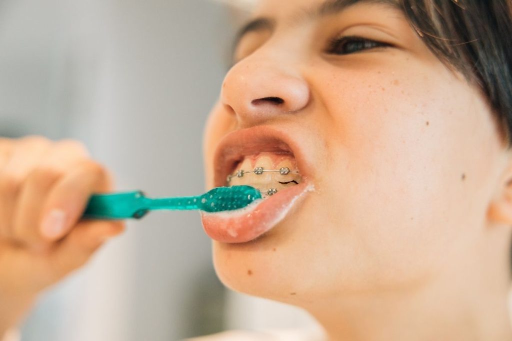 Orthodontic Hygiene