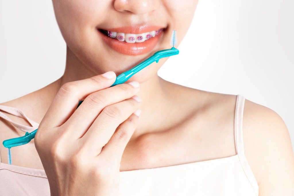 Avoid Stains During Orthodontic Treatment