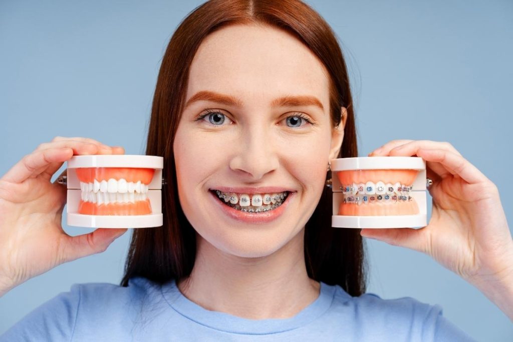 Smiling patient with braces displaying dental models showing before and after orthodontic treatment.