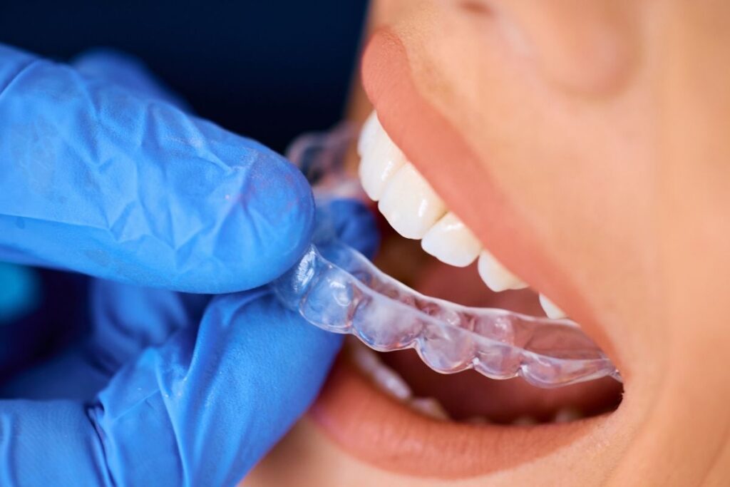 wearing Invisalign
