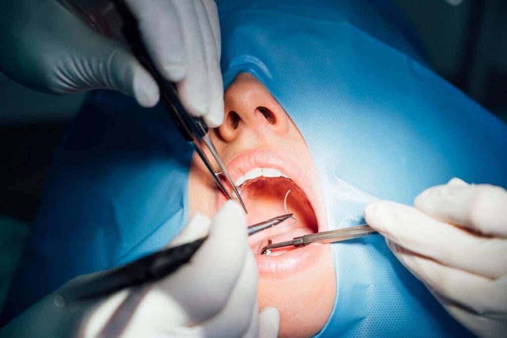 Food after Jaw Surgery