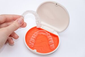 After Invisalign Treatment